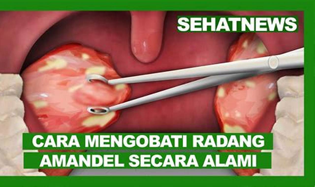 cara mengatasi amandel